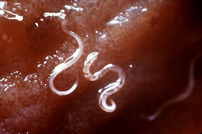 pasożyty u psa: tęgoryjce Ancylostoma caninum pod mikroskopem