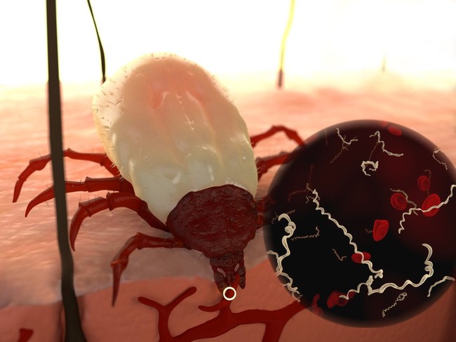 Zaznaczone ugryzienie przez kleszcza powodujące zakażenie bakterią Borrelia zaznaczone ugryzienie psa przez kleszcza powodujące zakażenie bakterią Borrelia